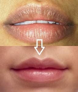 Cara Mengatasinya Bibir Hitam Dan Kering | Mazaya Skin Care