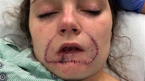 With so many accolades to its name, it's a wonder the place isn't completely overrun with tourists in the fall you don't realize how big russia is until you fly across it. South Carolina Woman Whose Ex-Boyfriend Bit Her Lip Off ...