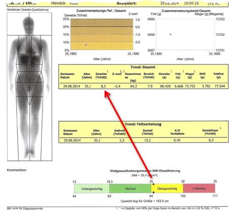 Körperfett (kg) = körpergewicht (kg) x körperfettanteil (%) BMI Berechnen: Verwende den BMI nur mit größter Vorsicht!