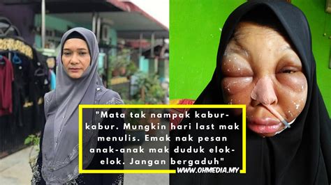 Kemudiannya pada februari, saya disahkan sudah menghidap kanser tahap empat. Ibu Hidap Kanser Lidah Tahap 4, Tinggalkan Nota Terakhir ...