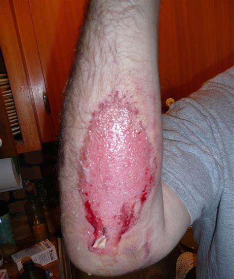 Check spelling or type a new query. Olympia Airglide Mesh Pants And Bushwhacker Jacket - Crash ...