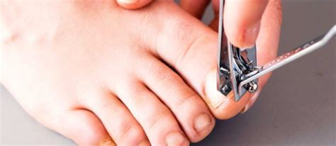 This article covers home in this article, we look at the safety considerations of cutting an ingrown nail at home, physician care gentler home remedies can work well to reduce the pain, and a person should visit a podiatrist or. Ingrown Toenails - Cartwright Podiatry