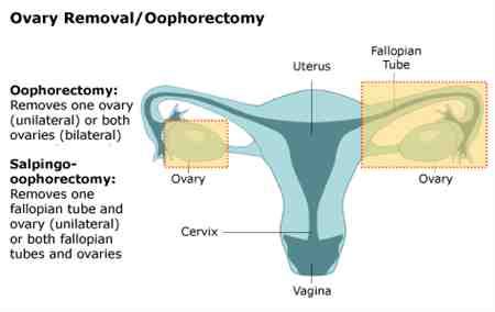 Both menarche and menopause affect breast cancer risk. Which Hormones Cause Arousal? Lumps 50 After Breast Benign ...