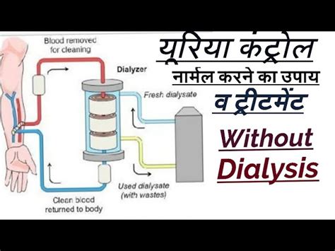 Agar aapki dry skin hai to aapke serum me kaun se ingredients zaruri hai, oily hai to kya or acne prone skin hai to kya. Kidney Test Kaise Kiya Jata Hai - kidneyoi