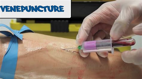 There are those that can be removed by the fingers. Venepuncture - How to take blood - OSCE guide - YouTube