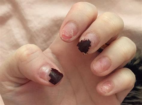 Umm.well if you leave the toe that doesn't have a nail exposed it'll take.about 4 somtimes to 12 months to fully be back and strong. How Long Does It Take For A Nail To Grow Back After Being ...