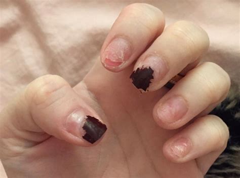 Apr 13, 2018 · if you happen to lose a fingernail, it may take up to six months for that nail to completely grow back. How Long Does It Take For A Nail To Grow Back After Being ...