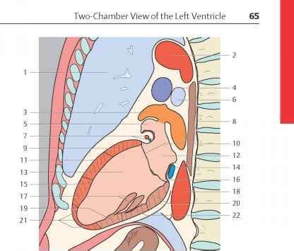 They extend over the left ventricle in a diagonal fashion they often run parallel to one another and are variable in number (often 2 to 9). Coronary Artery Anatomy - Sectional Anatomy - European Medical
