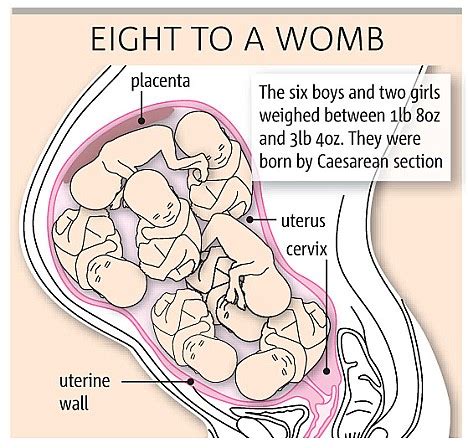 How long will it take for my belly to shrink back to normal? JOHN SMEATON, DIRECTOR OF SPUC: Ethical issues concerning ...