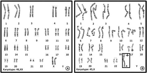 Maybe you would like to learn more about one of these? Meiosis Gizmo Answer Key Pdf Activity D - Cell Types Gizmo ...