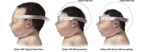 Material handling, motion control, safety, lighting & electrical Measuring Head Circumference (image reproduced from ...