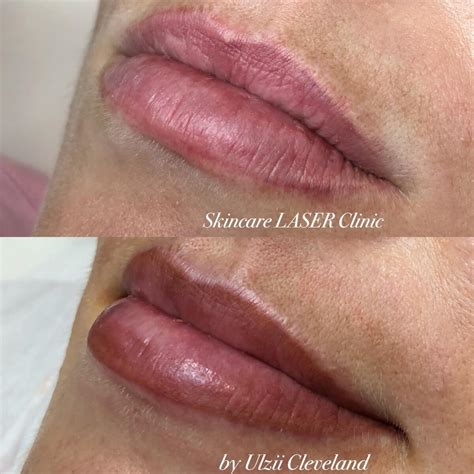 Please do this before you start getting tattooed. Lip Tattooing | Tattoo Lips Permanent Makeup | Cosmetic ...