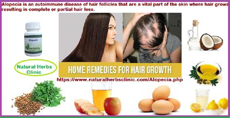 Natural remedies for hair loss. Herbal Remedies for Alopecia | Symptoms, Causes, Treatment ...