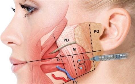 So what exactly is botox and how does it work? Botox Injections Can Help Treat Pain Caused by TMJ ...