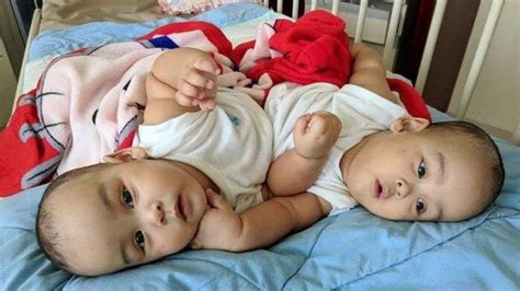 Berikut adalah kode bank cimb. Adam dan Malik Dalam Kondisi Sehat, Bayi Kembar Siam yang ...