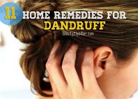 Another home remedy among 36 natural home remedies for dry scalp presented in this article is applying apple cider vinegar. 11 Natural Home Remedies for Dandruff | Look Good ...