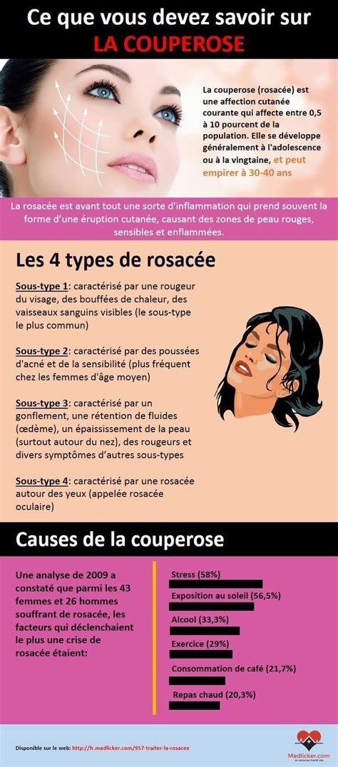 Sulfur 6 acne treatment language:de : Treat Rosacea: 6 natürliche Methoden für sich #für # ...