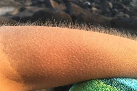 The reason goosebumps show up has to do with a tiny muscle that surrounds the root of every hair goosebumps are one of those signals. Getting goose bumps could boost hair growth - Tech Explorist