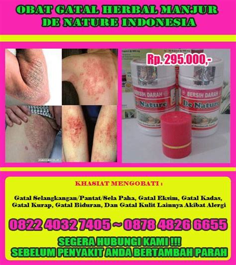 Anda boleh mencuba semua petua di atas untuk menghilangkan gatal di badan dan pada kulit. Obat herbal On Line: cara menghilangkan gatal di ...