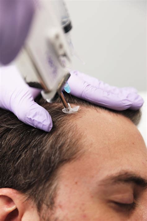 Hair loss treatments often targets the lack of protein content in the hair, egg alone will be able to fulfil the requirement. Hair Restoration - The One Clinic