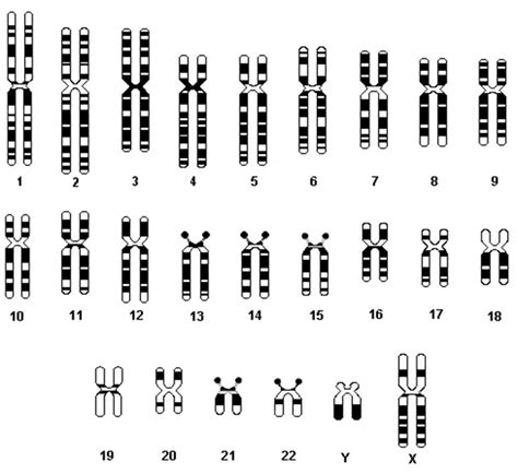 The missing chromosomes13 and 14 are not indicated because they are replaced by the dicentric. File:Chromosomes.jpg - WikiChristian