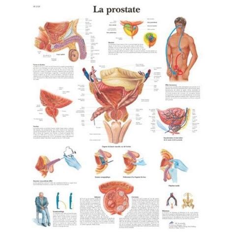 For specific prostate massage, once you have a finger or toy inside you, you aim to push on your prostate, which is a small gland that adds fluid as part of normal semen. Planche anatomique La prostate 3B Scientific VR2528L ...