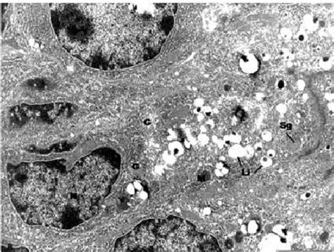 The principal cells in the dentate gyrus are granule cells, and these project to ca3. The ultrastructure of the two principal cells in the ...