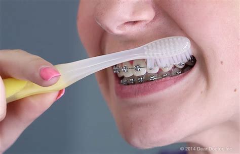 However, the total number of times you'll brush your teeth each day can vary, depending on how many times you eat meals and snacks, and drink beverages other than water. Ortodontie Cluj - Ortopractica - Aparat dentar Cluj ...