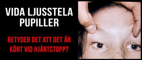 42,226 likes · 3,696 talking about this · 610 were here. Myt 1: Vida ljusstela pupiller utesluter bra outcome vid ...