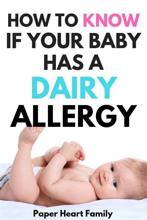 However, some continue to be allergic to milk until they are. "A list of milk allergy symptoms found in babies who ...