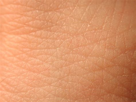 Skin diseases have a serious impact on people's life and health. Human Skin | hjs consulting