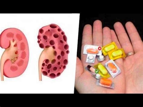 I am really standing on the word for yours and my healing. These are the 6 pills that end with your kidneys and you ...