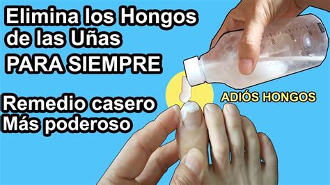 Y ese día fue el de la primera vez en que consumió hongos psylocibe. Esta Mezcla Elimina los Hongos de las Uñas de los pies y ...