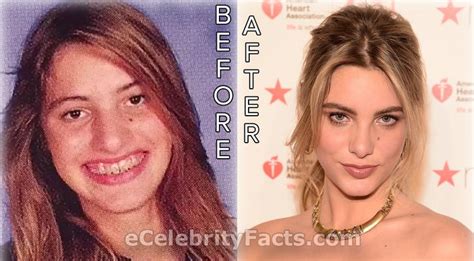 Lele pons se ha convertido en una de las infuencers más queridas de las redes sociales por su talento, carisma y pocas veces se ha visto una imágen de ella antes de dichos procedimientos quirúrgicos. Lele Pons has admitted to undergoing plastic surgery ...