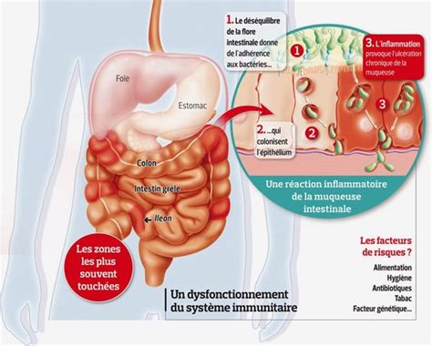 Bonjour, voilà ca fait des mois et des mois que j'ai des mycoses qui récidivent. Candida Albicans : Traitement naturel Candidose Chronique ...