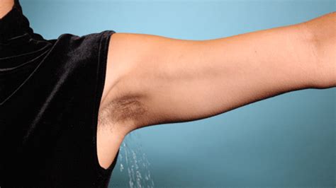 Infected hair follicles and exposure to scabies might also result in an armpit itch. Why don't Koreans produce bacteria causing body odor?