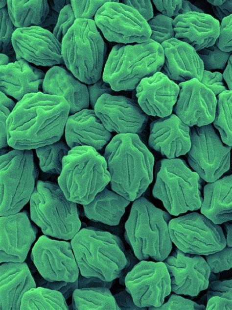 Mould Spores (rhizopus Oryzae) Photograph by Dennis Kunkel Microscopy ...