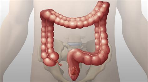 The part of the large intestine that extends from the cecum to the rectum. How to Clean your Colon | Colon Cleanse