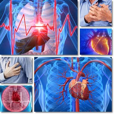 Heart attacks could be prevented by dietary modifications and lifestyle changes. 10 Tips to Prevent a Heart Attack - NatureWord