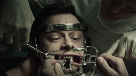 These films usually deal with very dark and terrifying subject matters. A Cure for Wellness (2017) Tooth Drilling Scene Explained ...