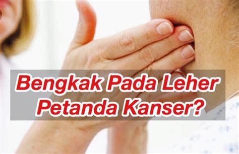 Pijatan gerakan memijat kelenjar yang sedang bengkak juga bermanfaat untuk mengobatinya. Bengkak Pada Leher Mungkin Petanda Kanser? Baca Penjelasan ...