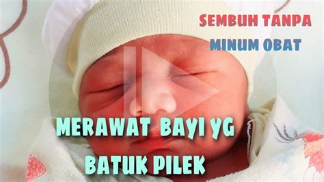 Pilek pada bayi ditandai dengan keluarnya ingus atau cairan jernih dari hidung, yang dapat berubah menjadi kekuningan atau kehijauan setelah satu minggu. Merawat bayi yang lagi batuk pilek - YouTube