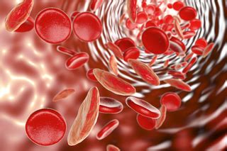 Anemia mediterránea — anemia hemolítica caracterizada por hematíes microcíticos, hipocrómicos y de vida corta, causada por una síntesis deficiente de hemoglobina deficiente. Anemia mediterranea: Malattie - Ematologia | Pazienti.it | Pazienti.it