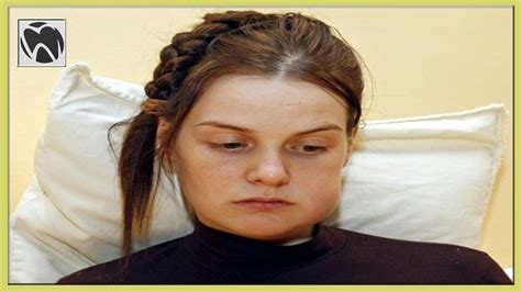 Sometimes, however, this change can cause teeth swelling. How To Reduce Wisdom Teeth Swelling in 5 Minutes | Wisdom ...