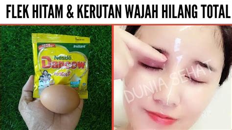 Kemerahan pada kulit pada umumnya bisa dikontrol dengan penggunaan kosmetik dan pembersih, tetapi kondisi. CARA TERBAIK MENGHILANGKAN FLEK HITAM & KERUTAN DI WAJAH ...