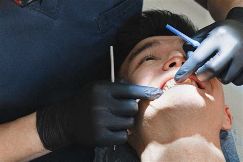Kanal Tedavisi Nasıl Yapılır? - Dental Park Ağız ve Diş Sağlığı ...