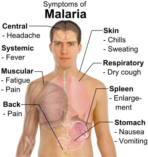 Maybe you would like to learn more about one of these? Infection Landscapes: Malaria Part 3: The disease