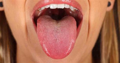 9 Fascinating Insights Your Tongue May Reveal About Your Health