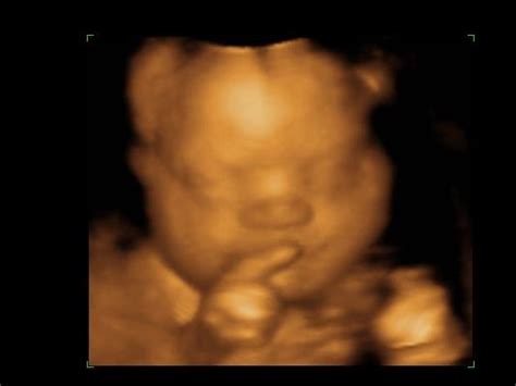 Get information, directions, products, services, phone numbers, and reviews on peek a boo ultrasound in victorville, undefined discover more medical laboratories companies in victorville on manta.com. Peek A Boo Baby 3D/4D Imaging in Westfield | 3D/4D Imaging