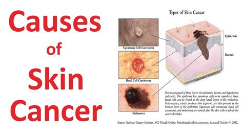 Talking with your cancer care team regarding hair loss may help you cope better with this side effect. SKIN CANCER SURGERY in Aligarh -Skin Hair Expert